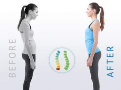 Posture Corrector – Adjustable Back Support Brace for Men & Women